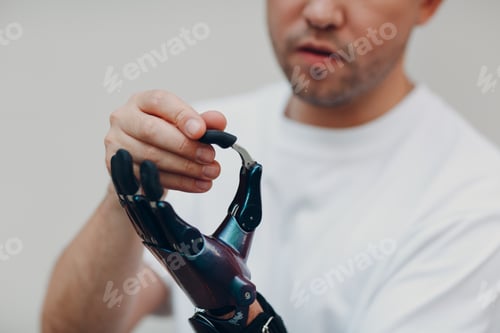 Preview: Young disabled man with artificial prosthetic hand put on finger nozzle pad.