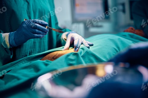 Preview: Close up of doctor using scalpel during surgery in operating room.