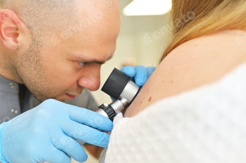 Preview: dermatologist oncologist uses a dermatoscope to examine moles and birthmarks on the patient's body