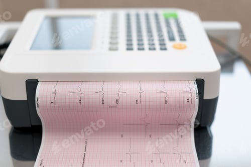 Preview: a cardiologist makes an ECG cardiogram for a patient prints an analysis of patient's pulse rate