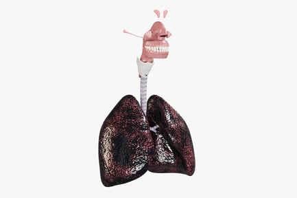 Preview: Advanced Smoker's Lungs with Upper Respiratory Tract Anatomy