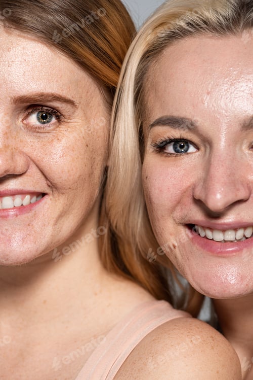 Preview: Cropped view of smiling women with skin issue looking at camera isolated on grey