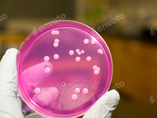 Preview: Doctor holding petri dish with microbe colony