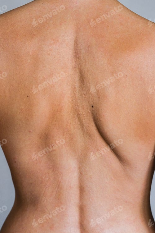 Preview: Psoriasis Skin Disease Is A Dermatic Problem, Red Allergic Skin Rash.