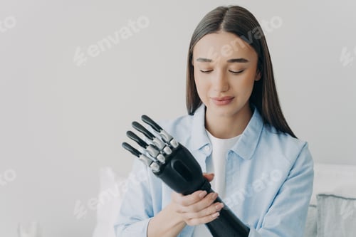 Preview: Pretty disabled girl puts together bionic prosthetic arm, adjusting position and grip of prosthesis