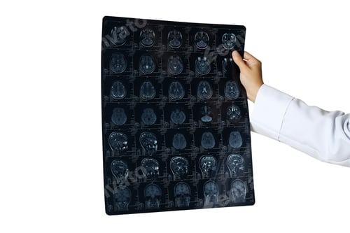 Preview: PNG, MRI images of a human head in the hands of a doctor, isolated on white background