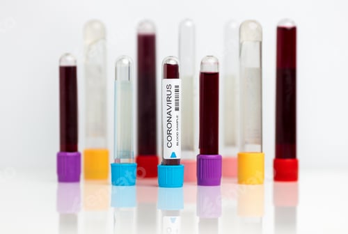Preview: Laboratory sample of the novel Coronavirus
