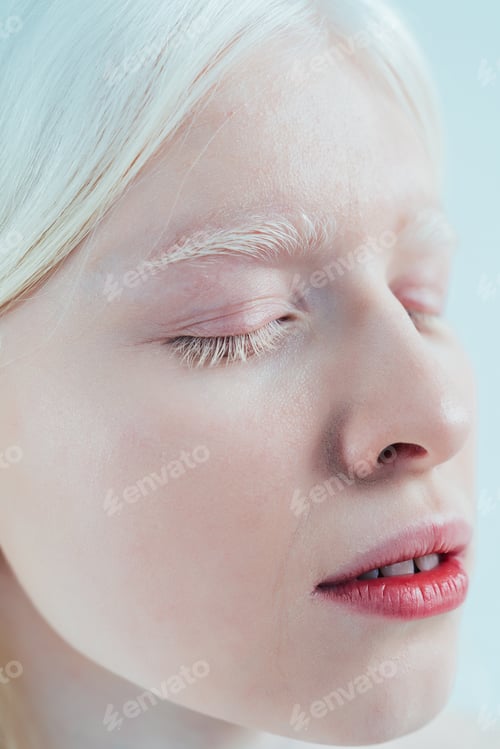 Preview: Beauty image of an albino