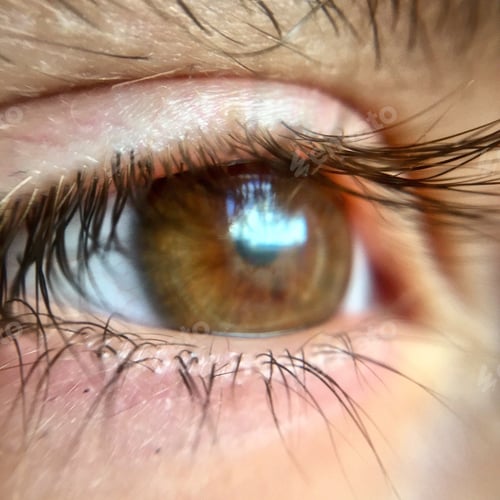 Preview: Human eye