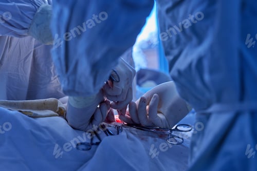 Preview: surgical operation close up, selective focus