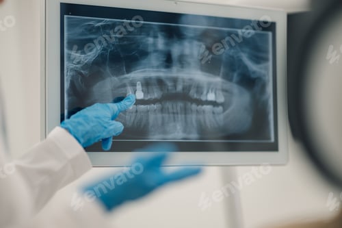 Preview: Dentist pointing at teeth x ray on computer screen discussing diagnosis