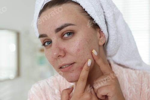 Preview: Woman popping pimple in bathroom. Acne problem
