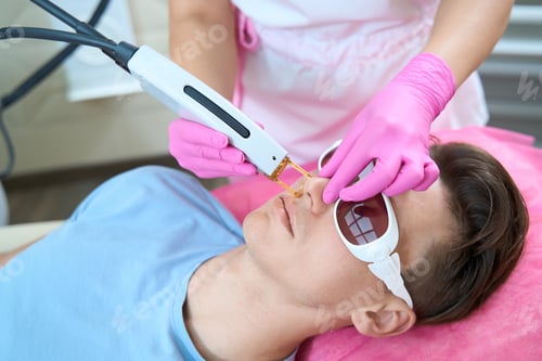 Preview: Cosmetologist doing laser epilation for male face