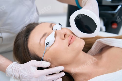 Preview: Femail patient undergoes a laser rejuvenation procedure n a medical center