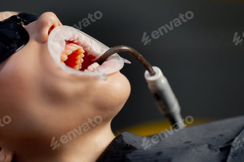 Preview: close-up in the dental office of young beautiful girl with a speculum in her mouth and black glasses