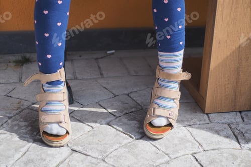 Preview: Child cerebral palsy disability legs orthosis shoes sitting on bench