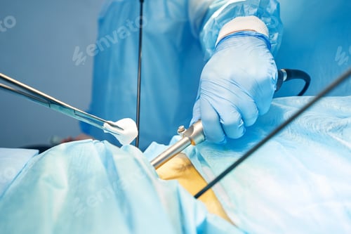 Preview: Surgical Procedure Performed by Medical Professional in Hospital
