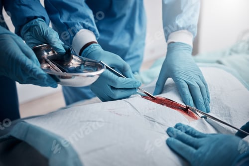 Preview: Doctors, nurses or surgery hands on cut patient in hospital emergency room for stomach ulcer, heart