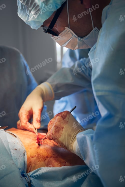 Preview: Surgeon Performing Operation in Hospital Operating Room