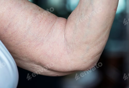Preview: Closeup of loose elderly arm
