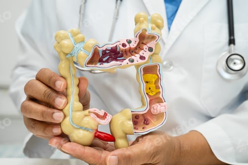 Preview: Intestine, appendix and digestive system, doctor holding anatomy model