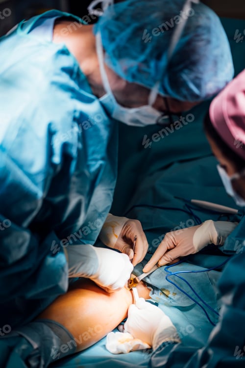 Preview: Doctors Perform Operation in Hospital Operating Room