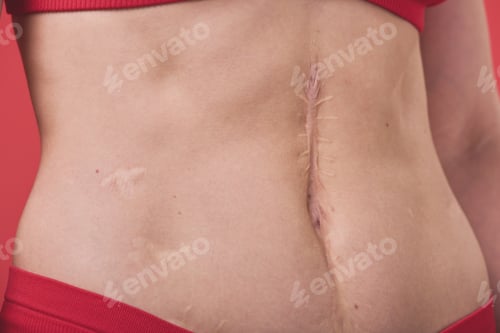 Preview: Female slim belly with scar