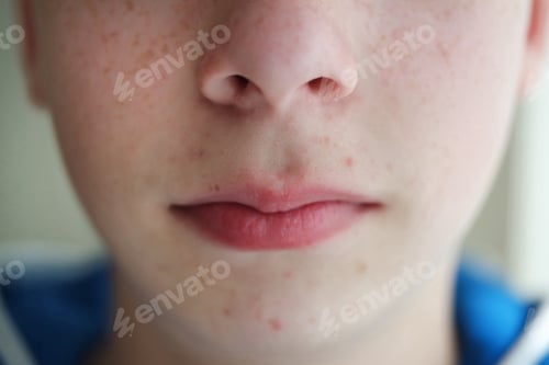Preview: Close up of the young teenage skin, nose and lips.