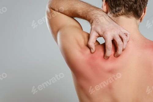 Preview: Partial view of man scratching skin with allergy isolated on grey