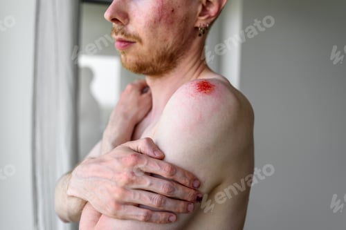 Preview: Man with many wounds on skin