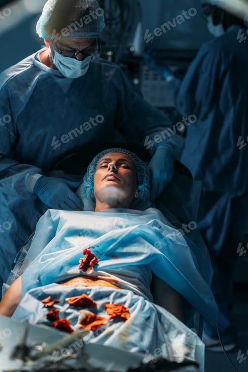 Preview: Doctors Performing Surgical Procedure in Hospital