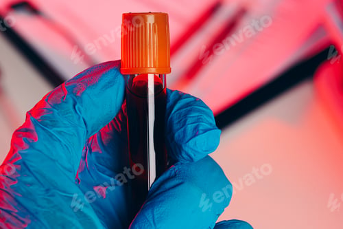 Preview: Doctor's hands in blue gloves keep test tube with a blood