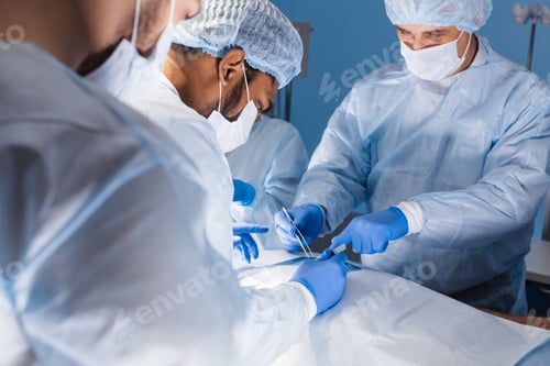 Preview: Surgical Team Performing Operation in Hospital