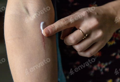 Preview: A scratch on a woman hand. Selective focus.