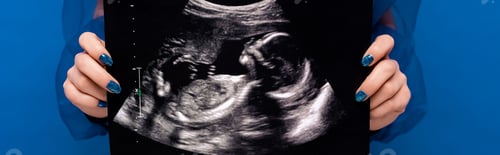 Preview: panoramic shot of woman holding ultrasound scan isolated on blue