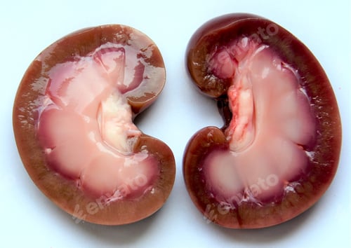Preview: Closeup shot of a human kidney cut in two
