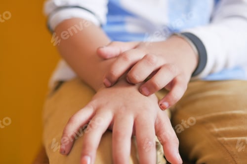 Preview: child girl suffering from itching skin on hand