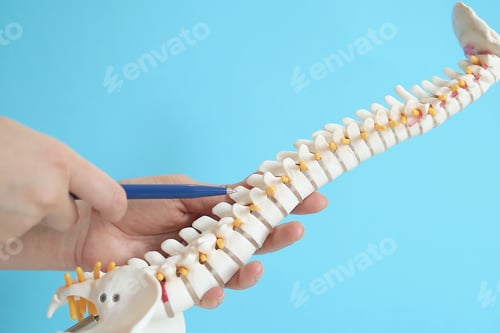 Preview: Intervertebral hernia of the cervical spine, rupture of the fibrous ring.