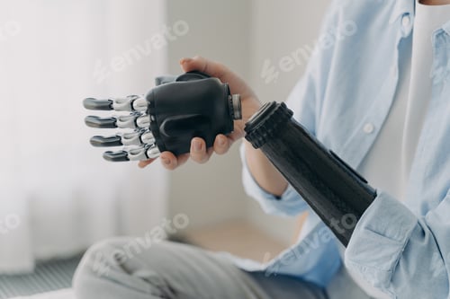 Preview: Artificial hand and arm with wrist joint. Disabled woman disassembling high technology prosthesis.