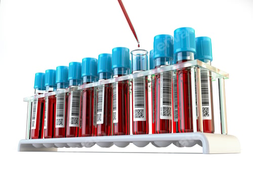 Preview: Blood Samples Being Analyzed in Medical Lab