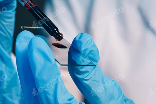 Preview: Hands of a laboratory worker doing blood test