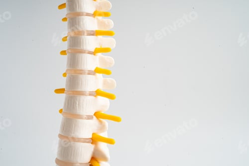 Preview: Lumbar spine displaced herniated disc fragment, spinal nerve and bone. Model for treatment medical