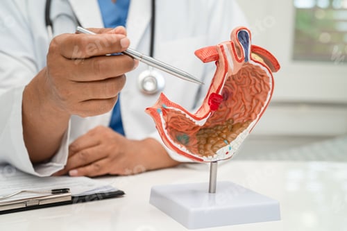 Preview: Stomach disease, doctor with anatomy model for study diagnosis and treatment in hospital.
