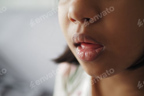 Preview: close up of dry lip of a child