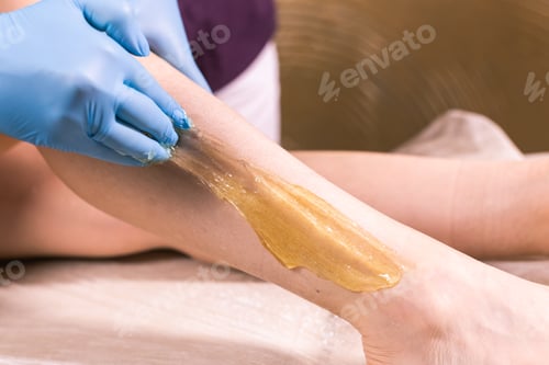 Preview: Woman having hair removal procedure on leg with sugaring paste in salon, close-up. Cosmetology