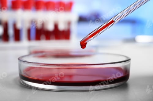 Preview: Pipetting blood into Petri dish for analysis on table in laboratory, closeup