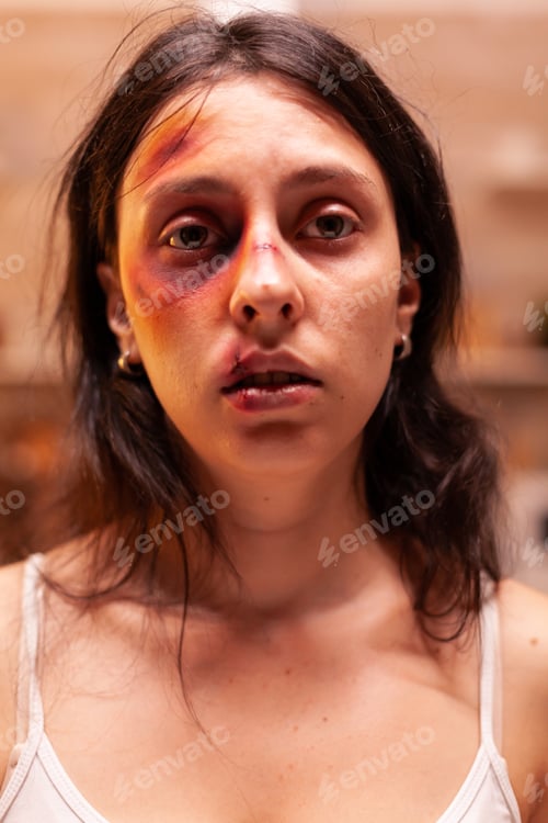 Preview: Wife brutally beaten