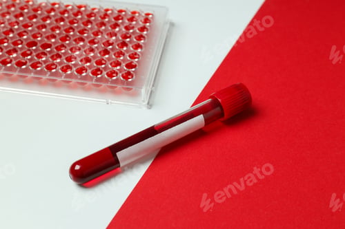 Preview: Human blood in test tubes on the table