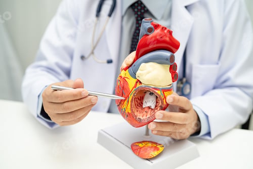 Preview: Cardiovascular disease CVD, Asian doctor holding human anatomy