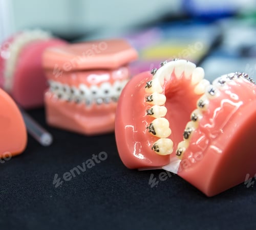 Preview: Dental or orthodontic tools, denture closeup